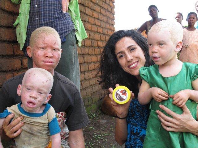 BASF y Beyond Suncare renuevan su cooperación para proteger a las personas con albinismo en África